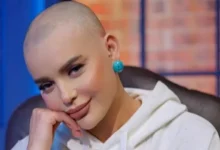 هبة السيسي والسرطان: تفاصيل الظهور حليقة الرأس ورحلة العلاج الكيماوي 2026