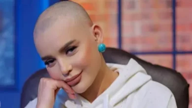 هبة السيسي والسرطان: تفاصيل الظهور حليقة الرأس ورحلة العلاج الكيماوي 2026